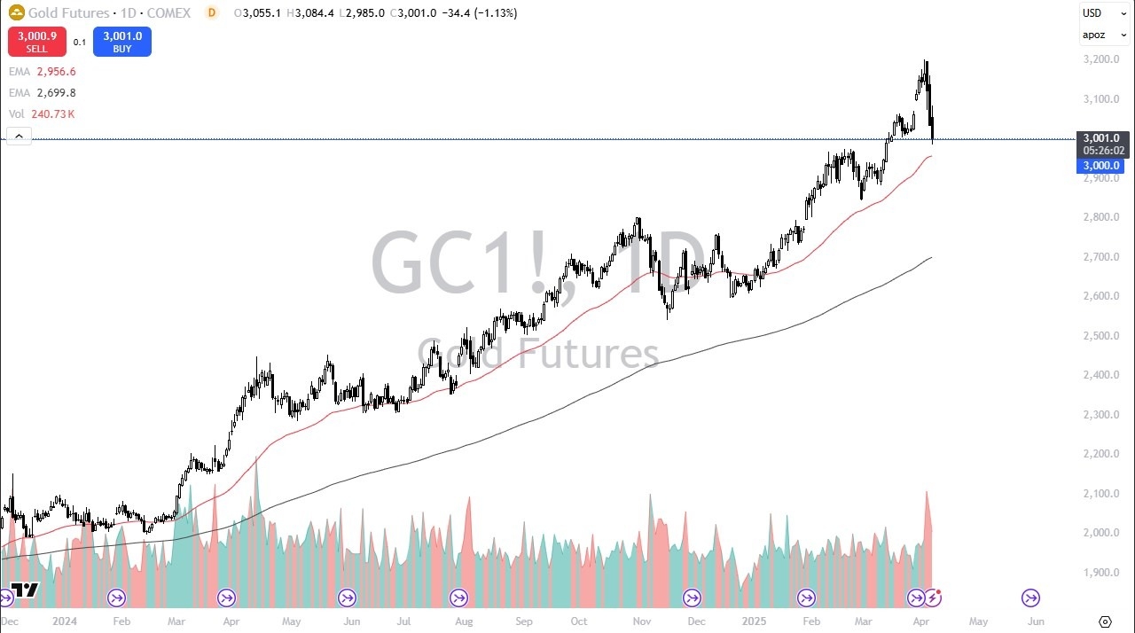 【XM Market Review】--Gold Forecast: Gold Hits Crucial Support as Selling Pressure Mounts(图1)