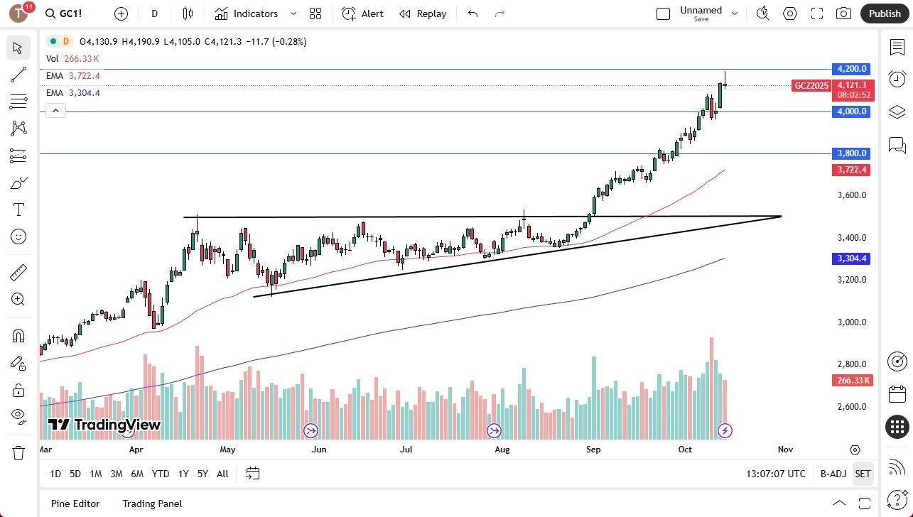 【XM Market Review】--Gold Forecast: Market Awaits Pullback for Value(图1)